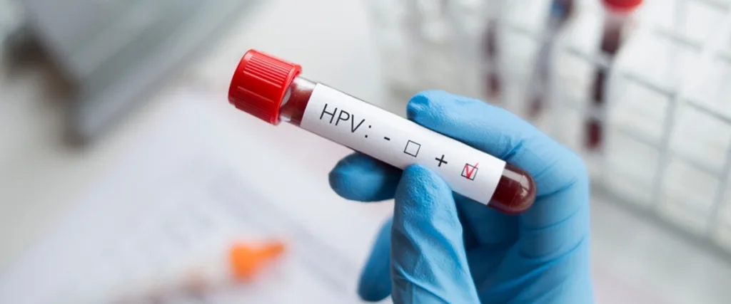 Understanding Genital Warts and HPV